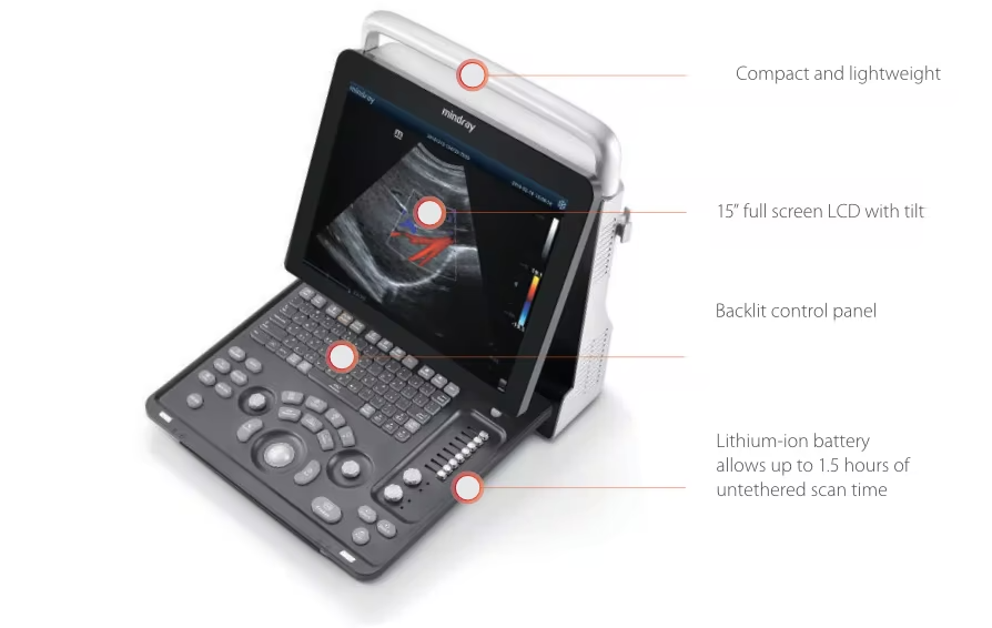 Portable ultrasound machine with a 15" tilt lcd, backlit control panel, and 1. 5-hour battery for untethered use.