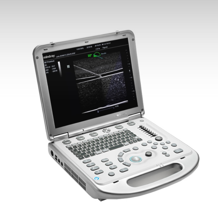 Portable ultrasound machine with keyboard and screen showing ultrasound images and controls on a lab-style base. Reflects a laptop-like medical scanner.