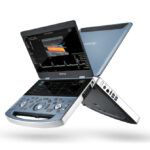Portable mindray ultrasound device with dual screens displaying ultrasound images and doppler graphs.
