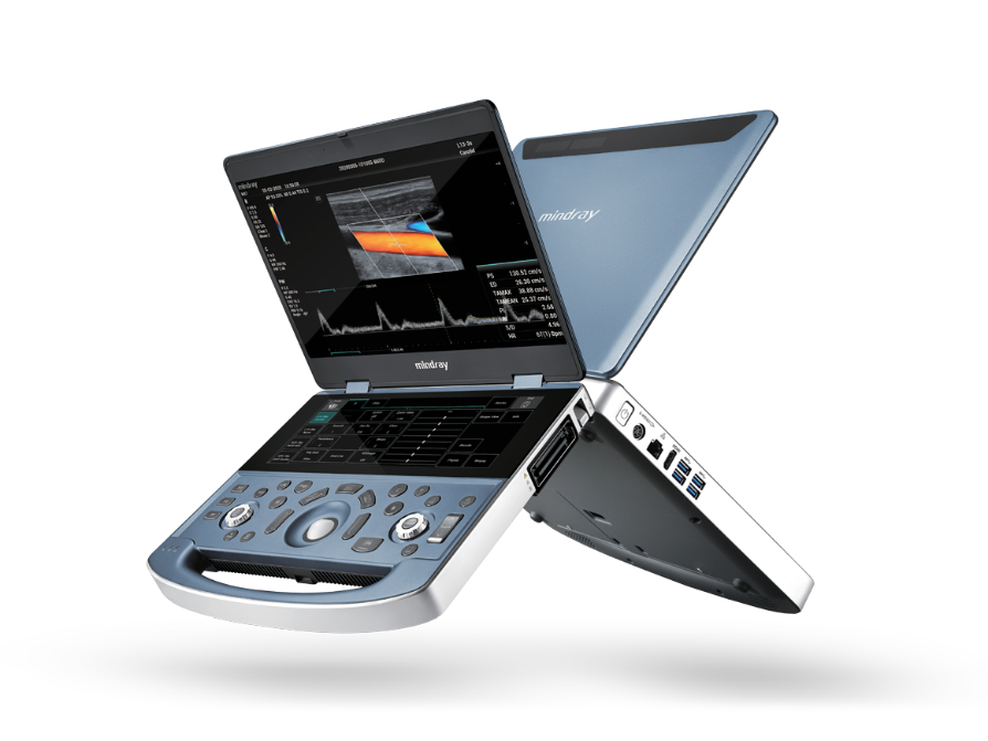 Portable mindray ultrasound device with dual screens displaying ultrasound images and doppler graphs.