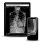 Tablet showing a chest and spine x-ray; a phone beside it shows a close-up joint x-ray.
