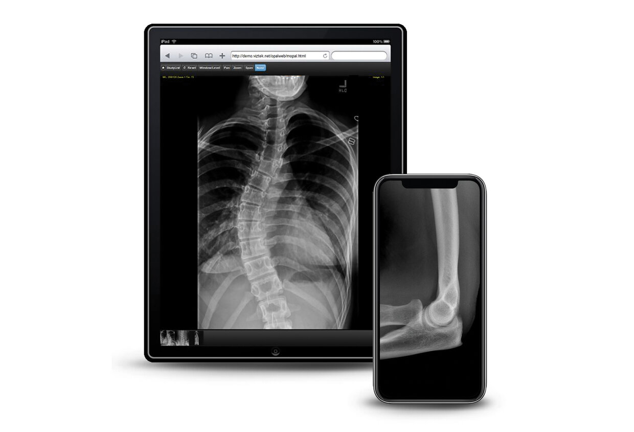 Tablet showing a chest and spine x-ray; a phone beside it shows a close-up joint x-ray.